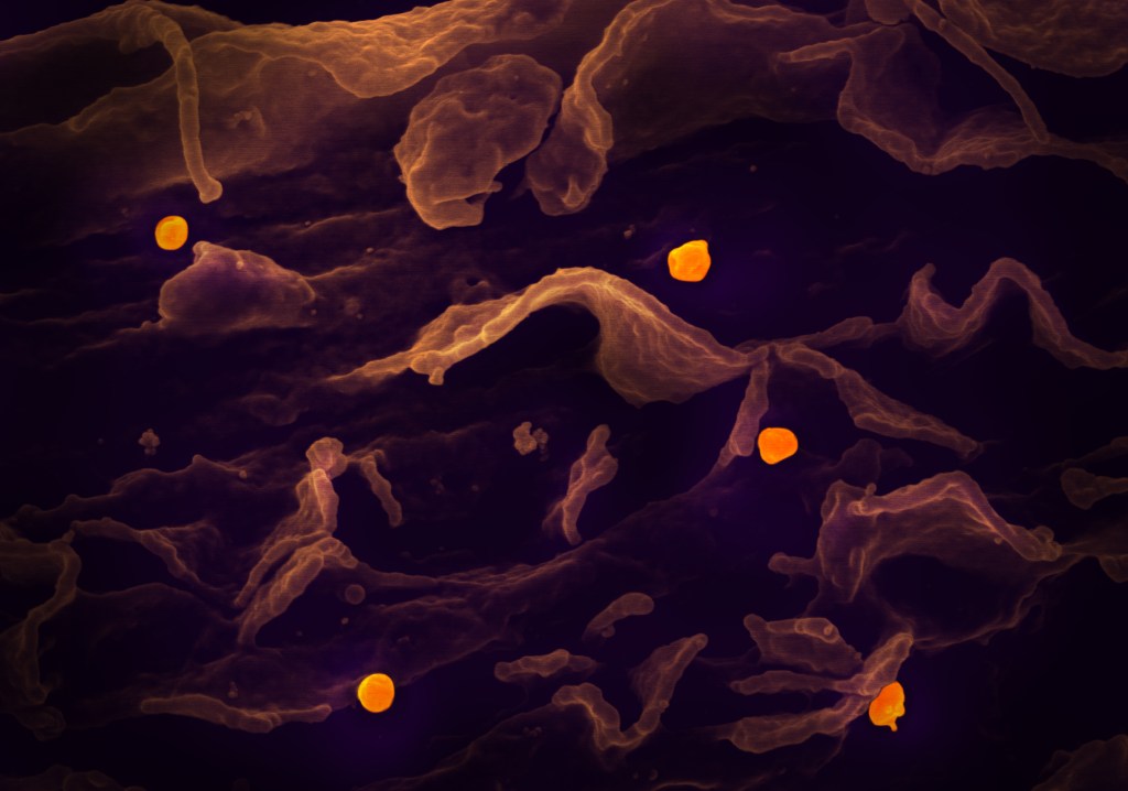 By NIH Image Gallery from Bethesda, Maryland, USA - Nipah Virus, Public Domain, https://commons.wikimedia.org/w/index.php?curid=87951779